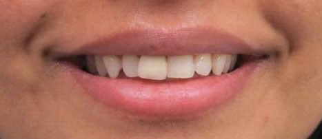 smile-gallery gallery