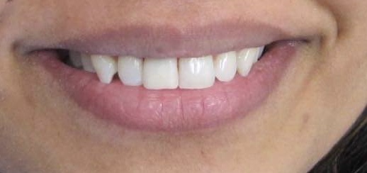 smile-gallery gallery