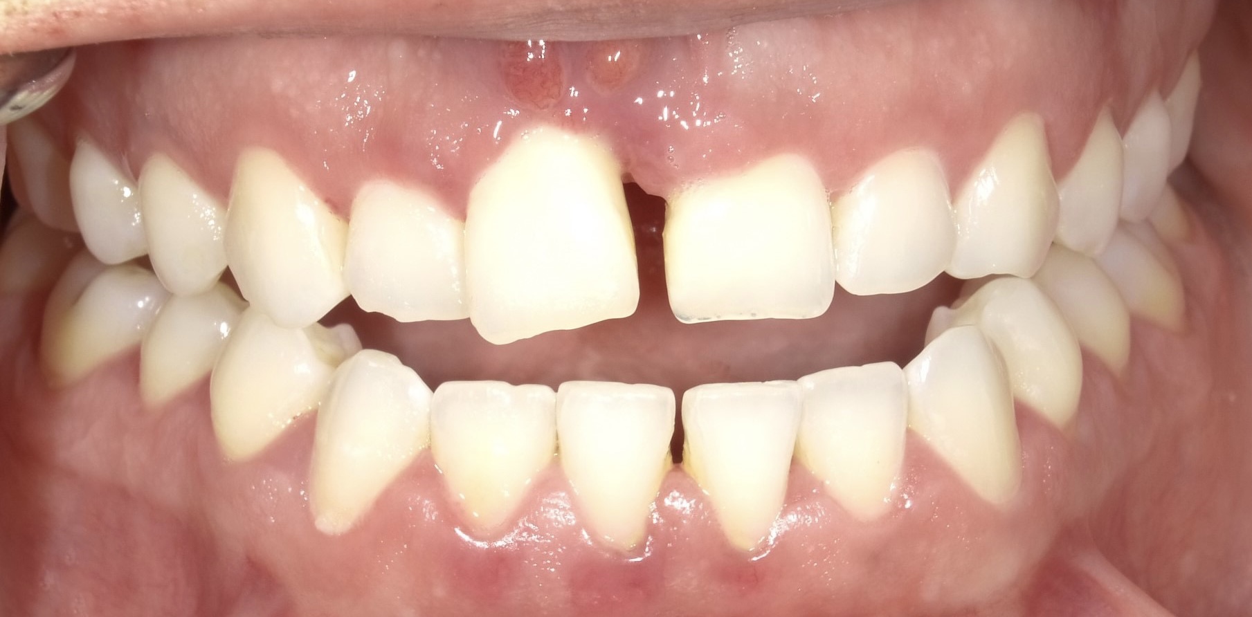 smile-gallery gallery