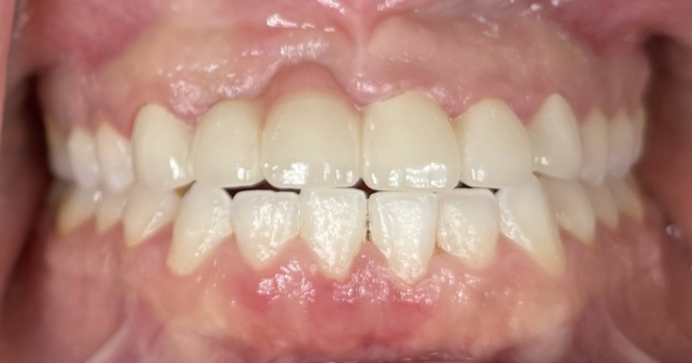 smile-gallery gallery