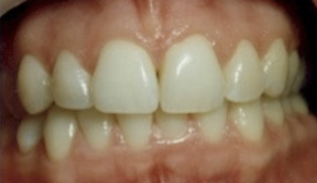 smile-gallery gallery