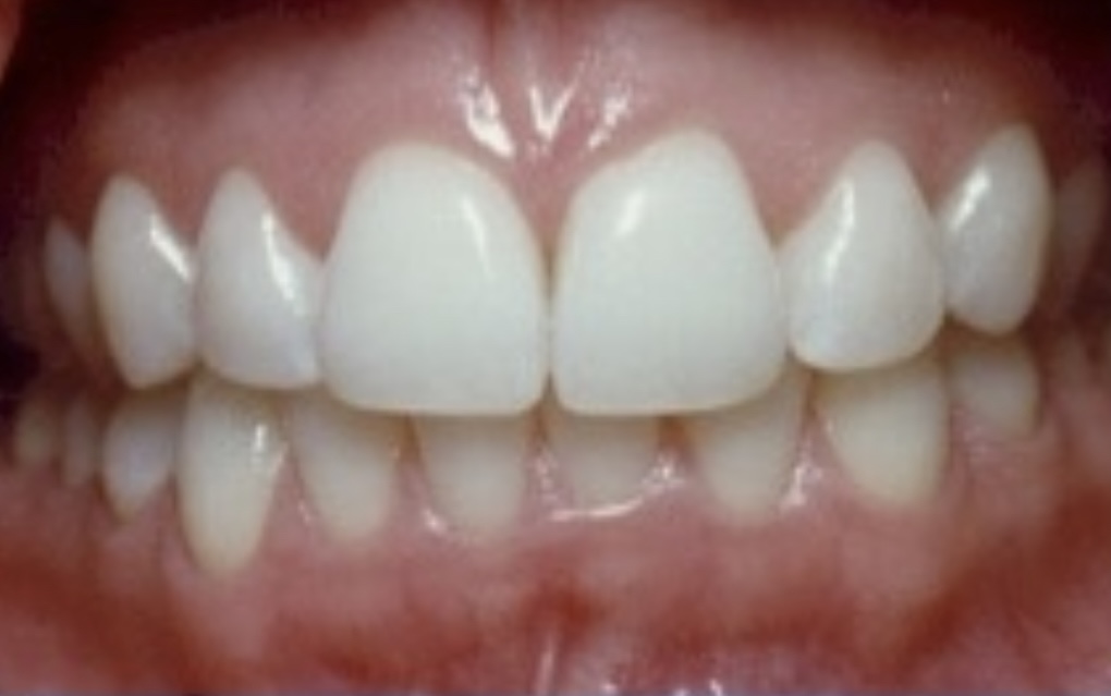 smile-gallery gallery